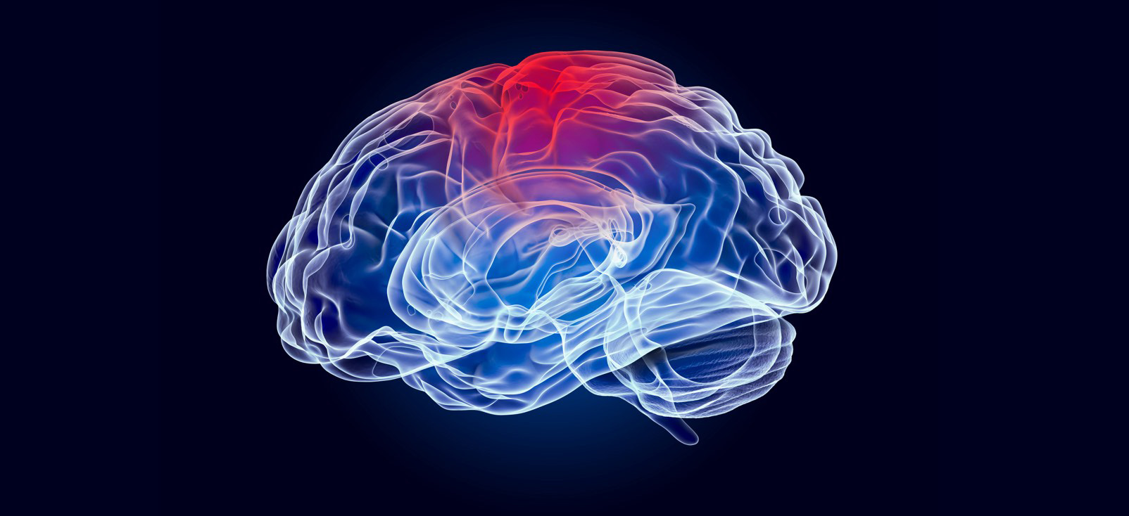 A graphical representation of a traumatic brain injury